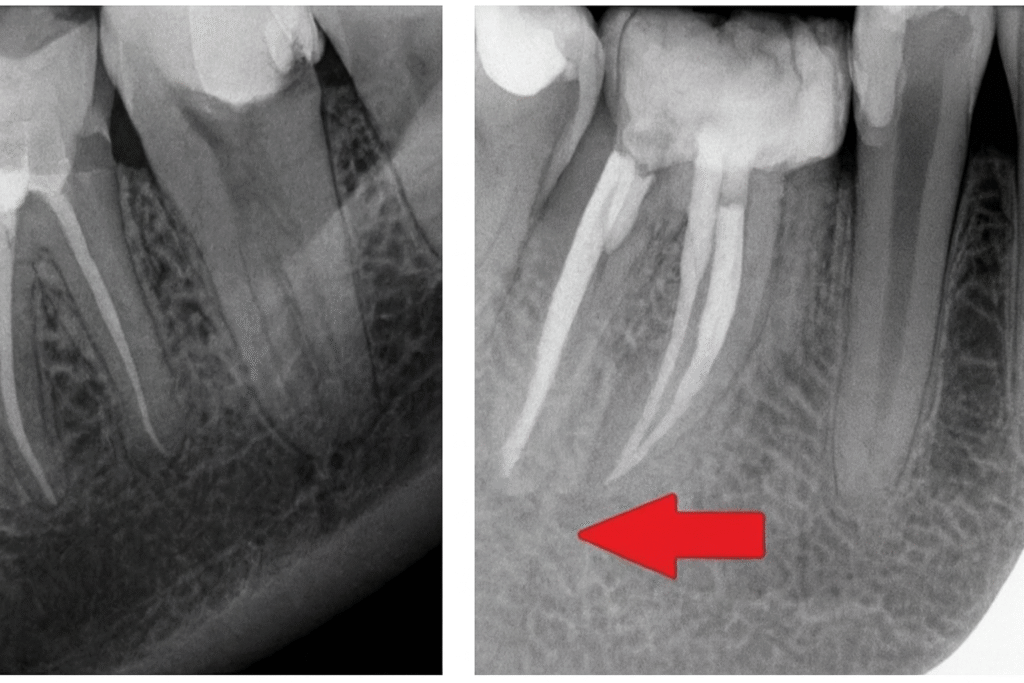 Radiowizjografia cyfrowa